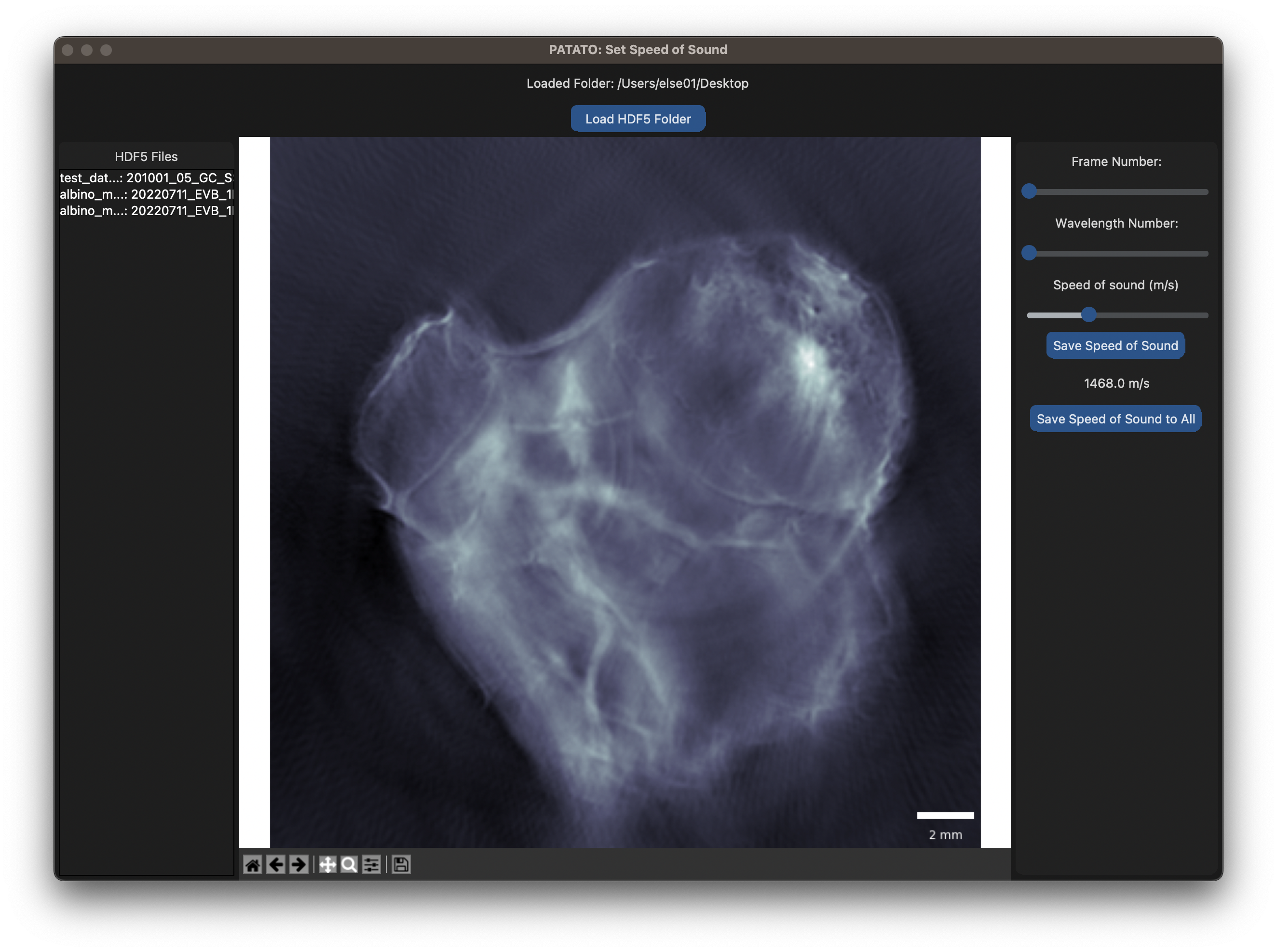Image of speed of sound setting interface.