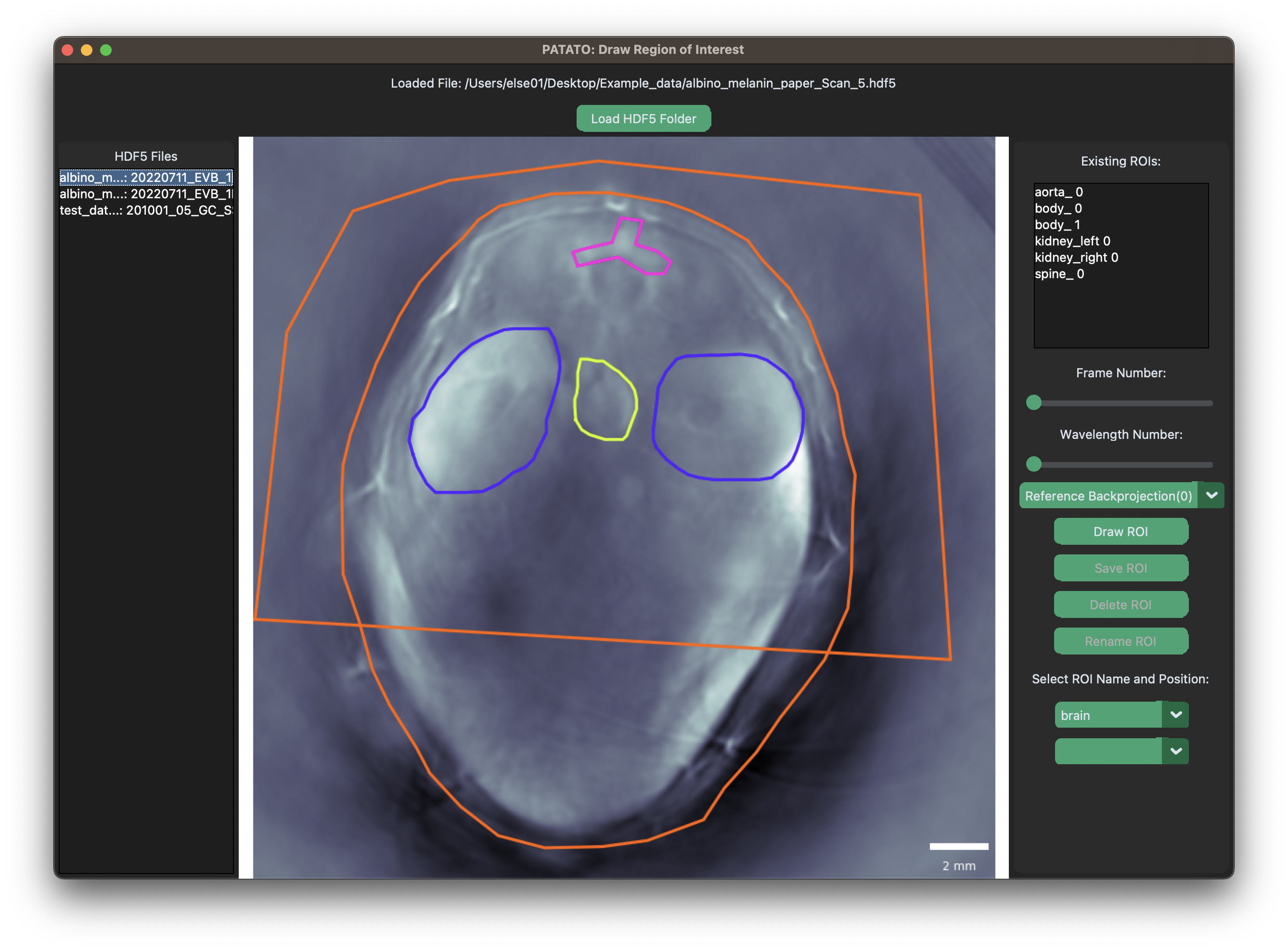 Image of ROI drawing interface