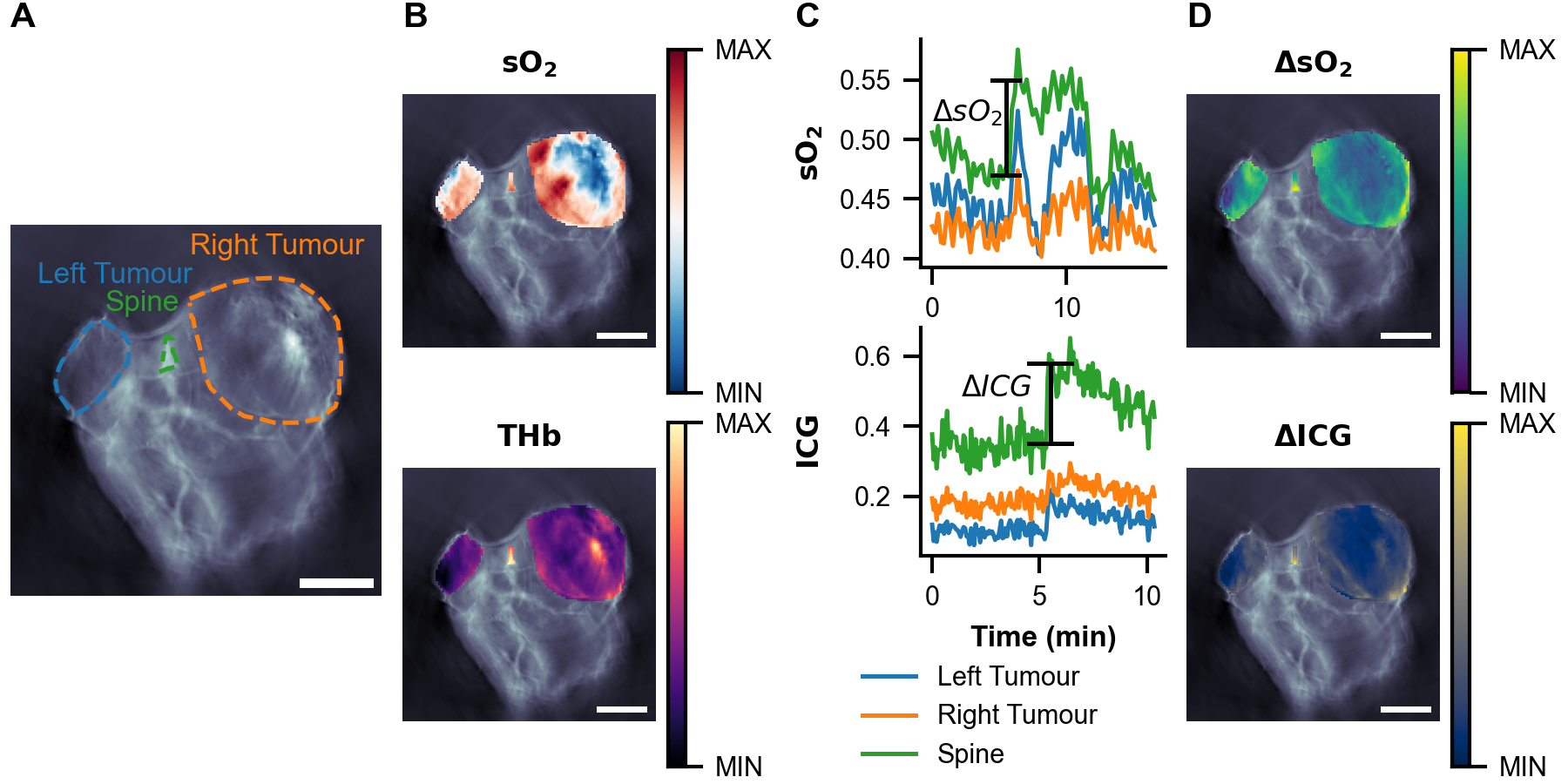 Overall figure showing the oxygen enhanced imaging and dynamic contrast enhanced analysis procedure.